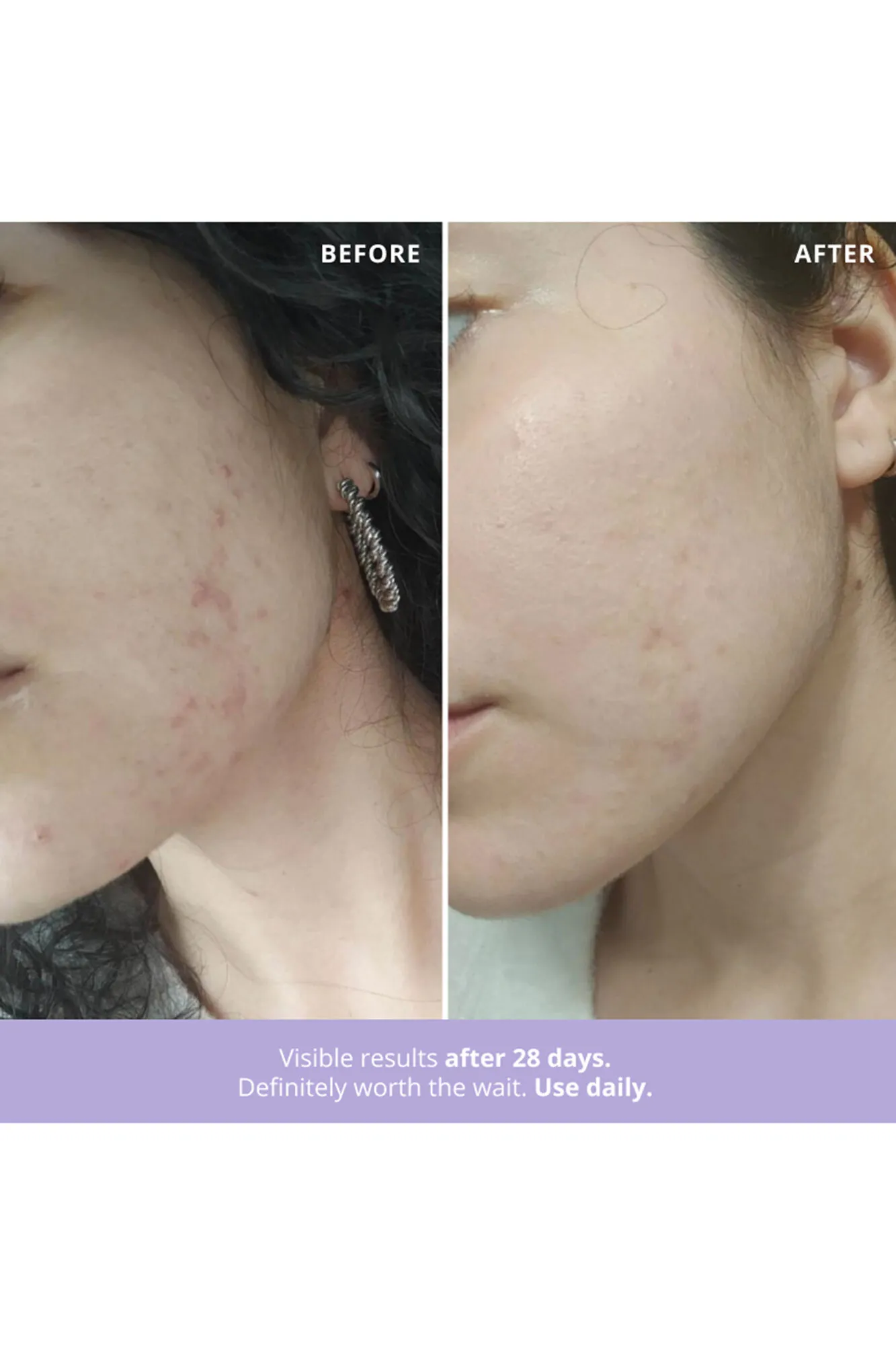 Azelaic Radiance Tratamiento facial